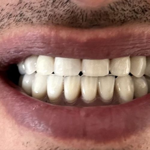لابراتوار دندانسازی