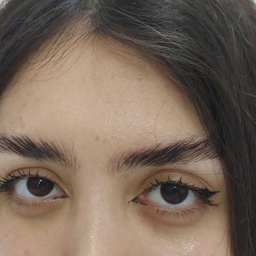 لیفت و لمینت و بوتاکس مژه و ابرو