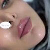 خدمات ژل لب فیلر بوتاکس مزو تراپی چالگونه پرسینگ