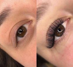 کاشت مژه تا 30 روز