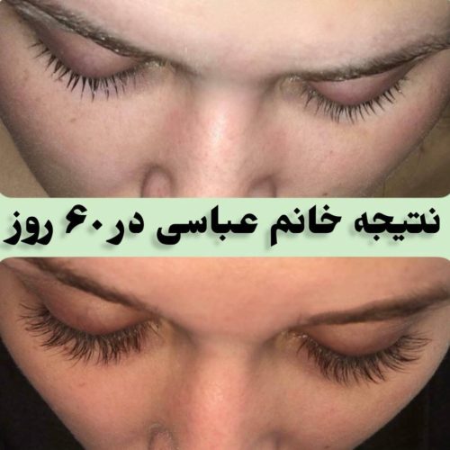 مژه وابرو طبیعی داعم
