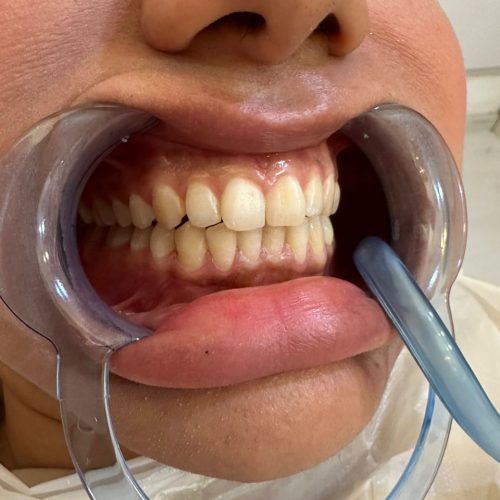 خدمات دندانپزشکی  بصورت نقد اقساط  با تخفیف 35درصدی