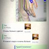 طب سوزنی و سوجوک تراپی توسط پزشک