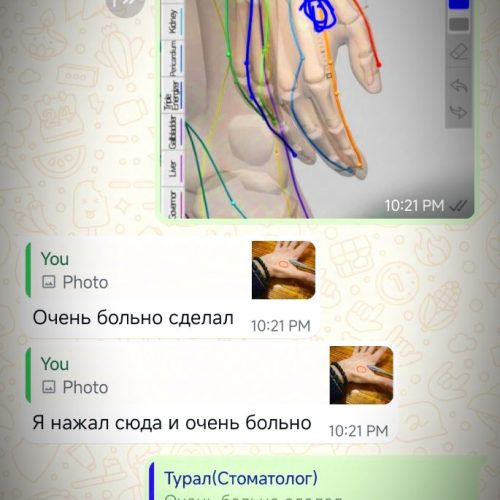 طب سوزنی و سوجوک تراپی توسط پزشک