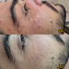 فیشال و پاکسازی پوست آقایون و بانوان