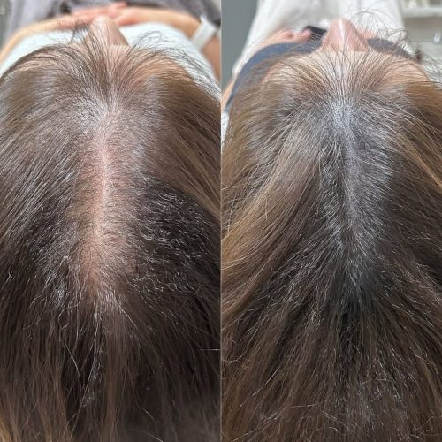 خدمات ژل لب فیلر بوتاکس مزو تراپی چالگونه پرسینگ