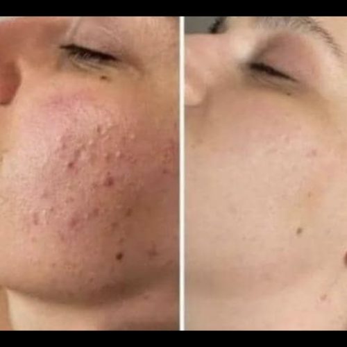 کرم شب و روز روشن کننده و ضد لک تضمینی