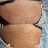 فیشال و پاکسازی پوست آقایون و بانوان