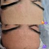 فیشال و پاکسازی پوست آقایون و بانوان