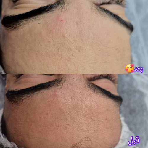 فیشال و پاکسازی پوست آقایون و بانوان