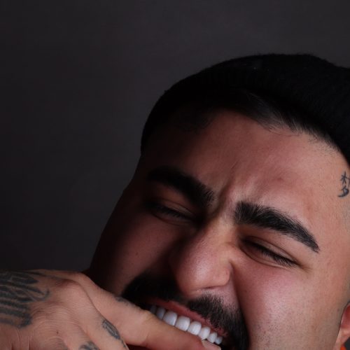 کامپوزیت بدون پیش پرداخت