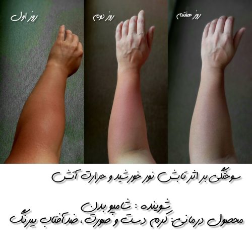 پاکسازی پوست