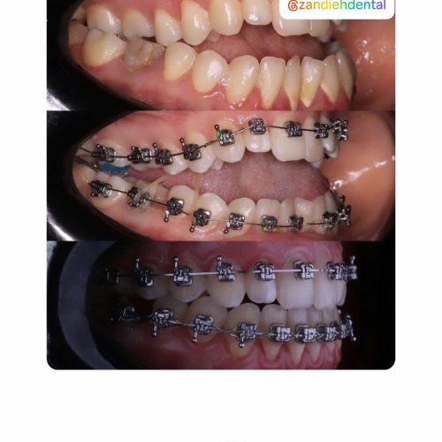 ارتودنسی و خدمات درمانی اقساطی