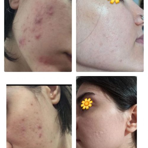 پاکسازی پوست