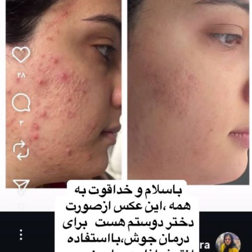 پاکسازی پوست