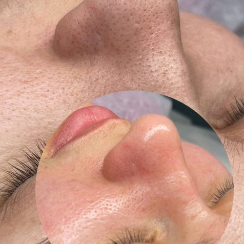 ‌مدل فیشال جهت تکمیل عکس پیج