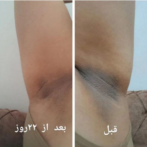 پاکسازی پوست