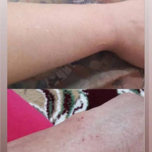 پاکسازی پوست