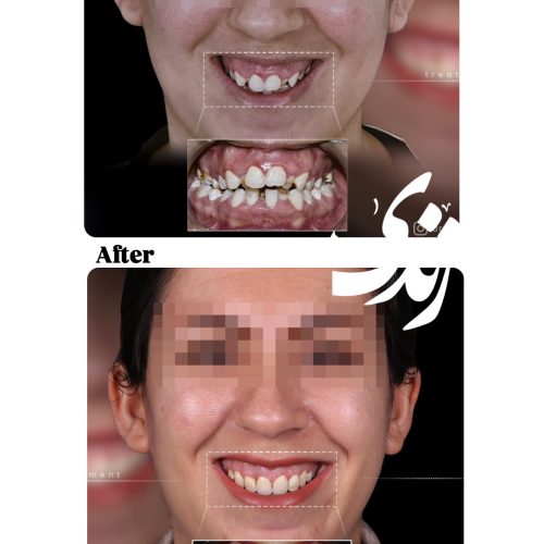 ارتودنسی و خدمات درمانی اقساطی