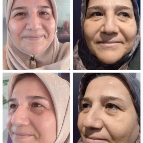 پاکسازی پوست