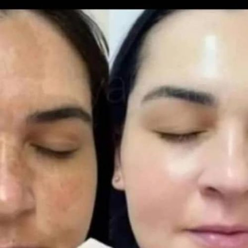 معجزه دست ساز