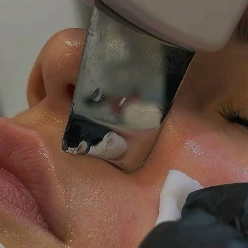 ‌مدل فیشال جهت تکمیل عکس پیج