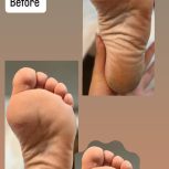 پدیکور تخصصی پا