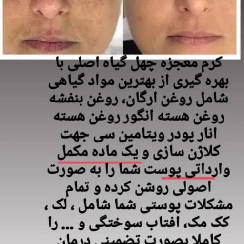 معجزه دست ساز