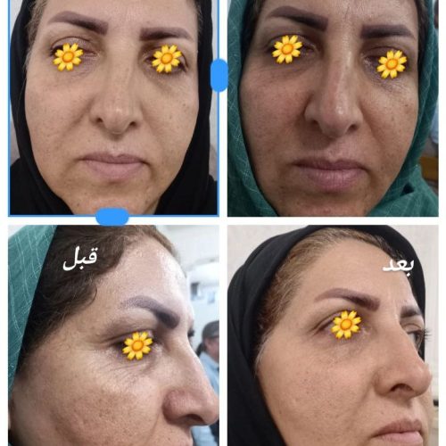 پاکسازی پوست