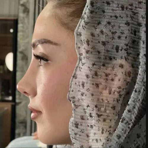 انواع جراحی و عمل زیبایی بینی/صورت/پیکرتراشی