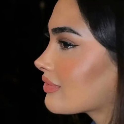 انواع جراحی و عمل زیبایی بینی/صورت/پیکرتراشی