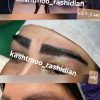 کاشت مو و ابرو پی آر پی و مزوتراپی مو ابرو صورت دست ریش