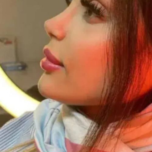 انواع جراحی و عمل زیبایی بینی/صورت/پیکرتراشی