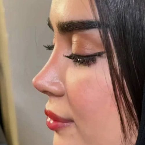 انواع جراحی و عمل زیبایی بینی/صورت/پیکرتراشی