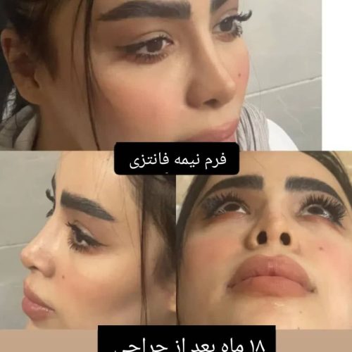 انواع جراحی و عمل زیبایی بینی/صورت/پیکرتراشی