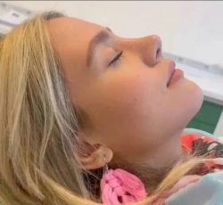 انواع جراحی و عمل زیبایی بینی/صورت/پیکرتراشی