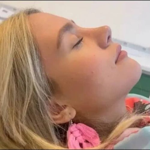 انواع جراحی و عمل زیبایی بینی/صورت/پیکرتراشی