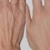 کلیه خدمات فیلر و بوتاکس