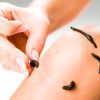 طب سنتی_ حجامت_ زالودرمانی_فصد خون