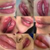 کلیه خدمات فیلر و بوتاکس