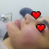 کلیه خدمات فیلر و بوتاکس