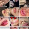 کلیه خدمات فیلر و بوتاکس