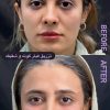 خدمات زیبایی مطب دکتر خلیل زاده در گلسار