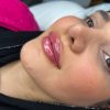 خدمات زیبایی مطب دکتر خلیل زاده در گلسار