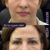 خدمات زیبایی مطب دکتر خلیل زاده در گلسار