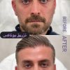 خدمات زیبایی مطب دکتر خلیل زاده در گلسار