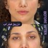 خدمات زیبایی مطب دکتر خلیل زاده در گلسار