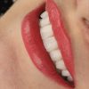 کاشت ایمپلنت تخصصی با اقساط ویژه و خدمات دندانپزشکی حرفه ای