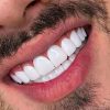دندانپزشکی کامپوزیت روکش عصب کشی و ترمیم
