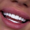 دندانپزشکی کامپوزیت روکش عصب کشی و ترمیم